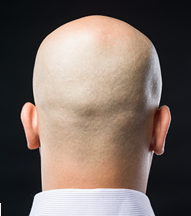 Bald.PNG