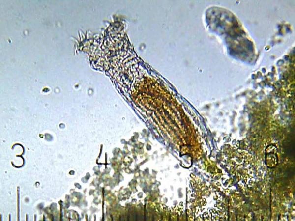 Bdelloid_Rotifer.jpg