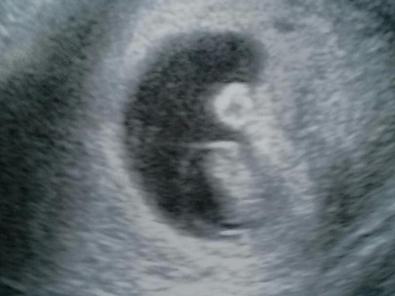 Baby - 7 Weeks.jpg